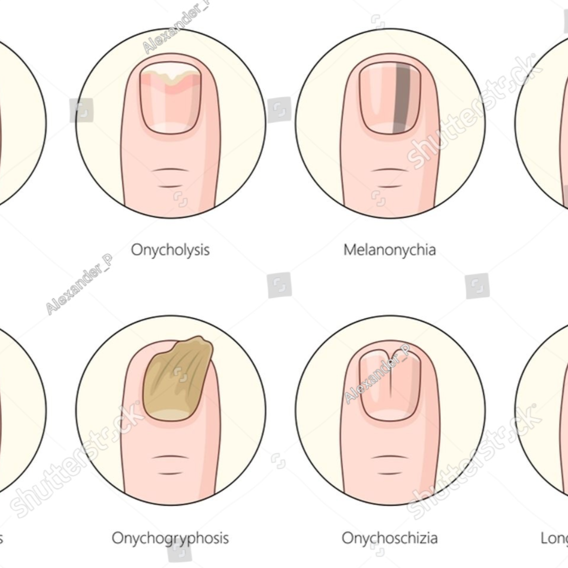 feature-item-3